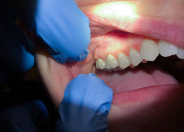 Best Broken Tooth Emergency  in South Haven, IN